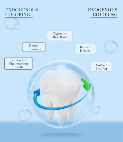 Teeth Whitening Kit With Led Light - Trending Gay